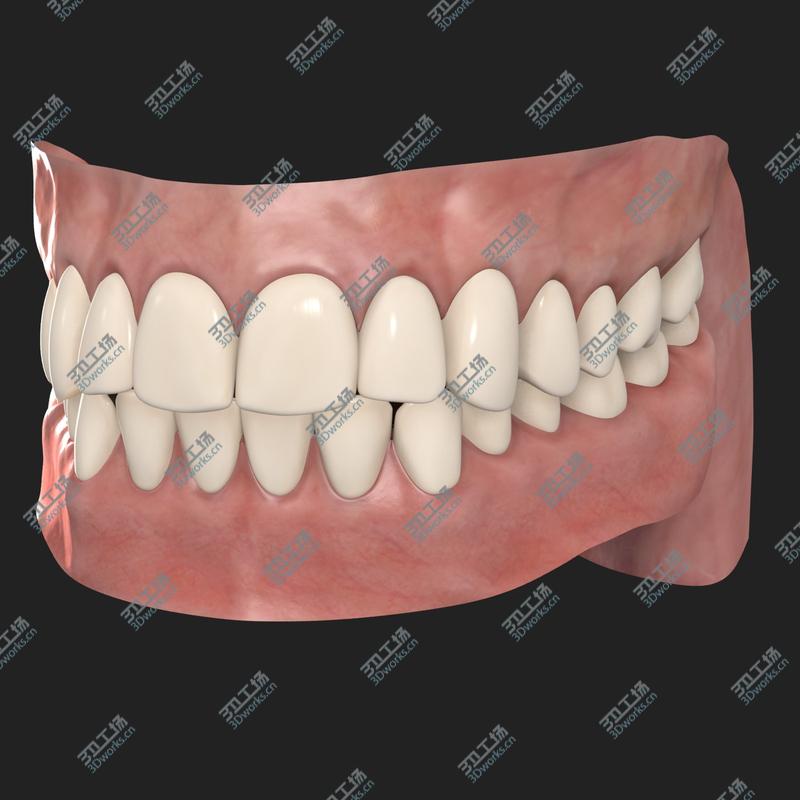 images/goods_img/2021040233/Teeth/3.jpg