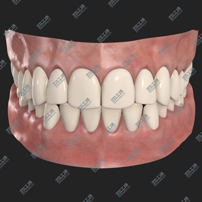 images/goods_img/2021040233/Teeth/5.jpg